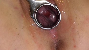Breeding Analslut - removing her birth control - Analslut's cunt opened wide with speculum showing her cervix.  Her IUD, coil removed with Forceps - leaving her with no birth control